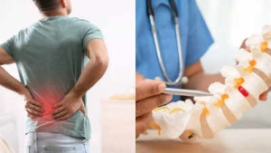 Is It Back Pain or a Slipped Disc? Key Differences to Know for Diagnosis and Relief